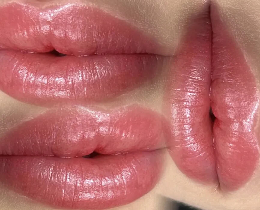 Diamond Lips - Results